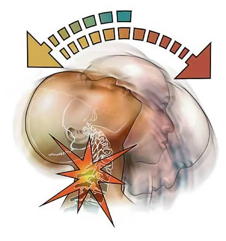 Chiropractic Care for Whiplash: Easing Pain and Restoring Mobility