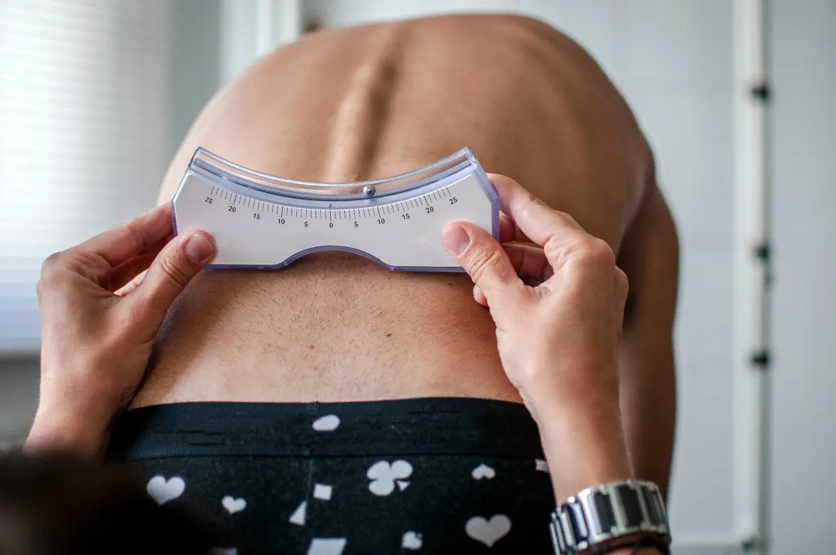 Scoliosis and Posture: Tips for Maintaining a Healthy Spine