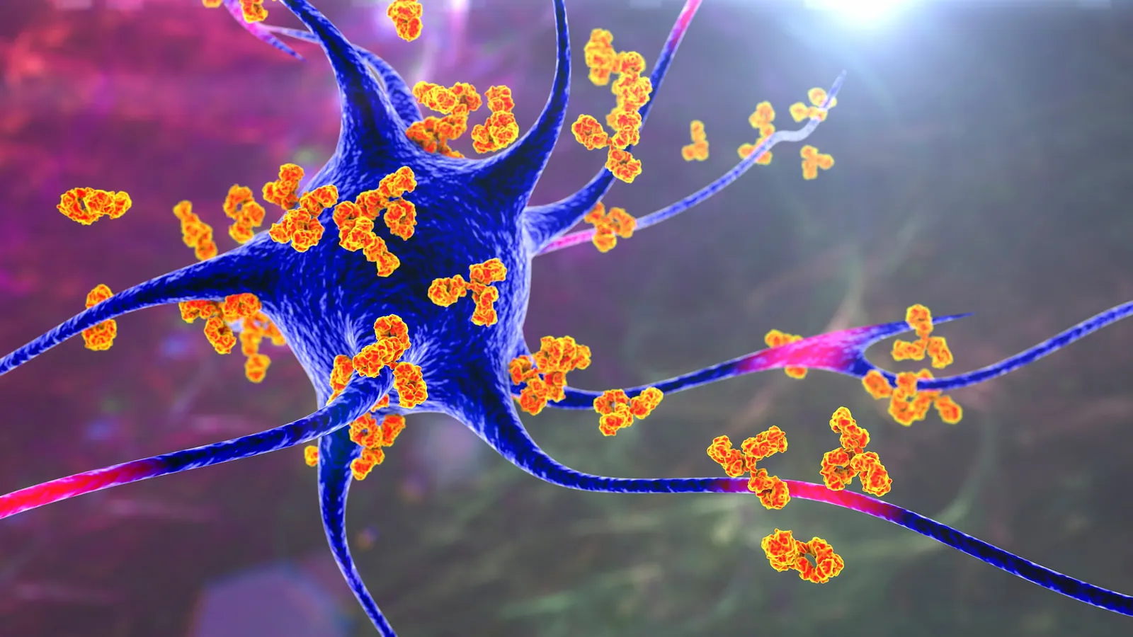 autoimmune disease image sample