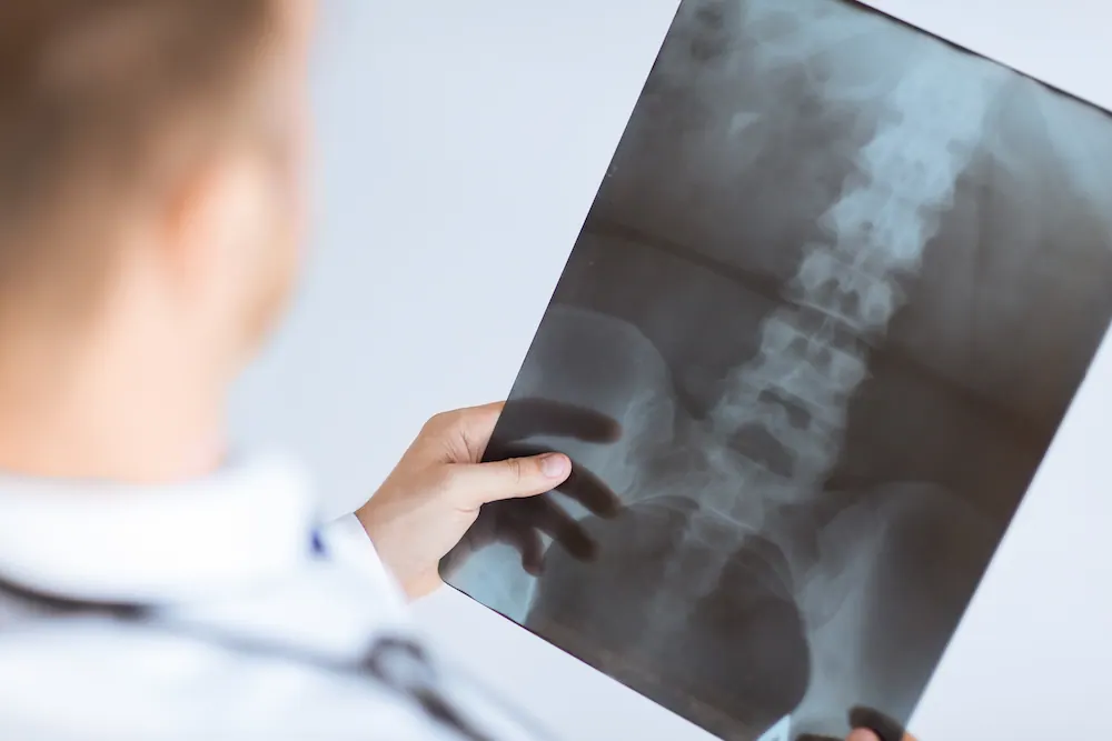 doctor looking at the spine xray result