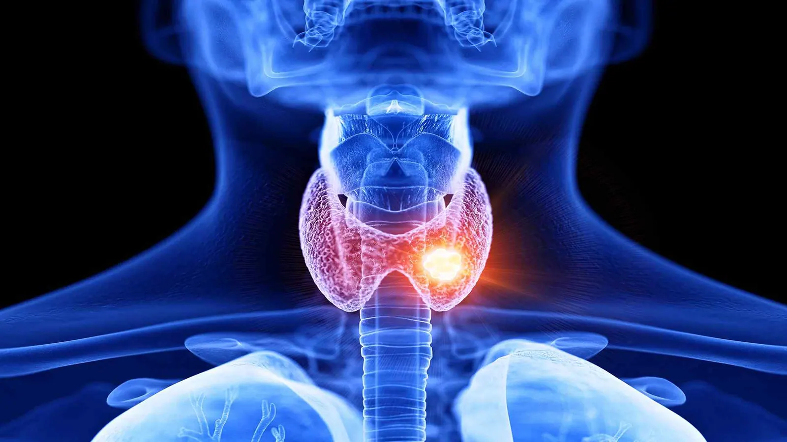 thyroid gland imaging